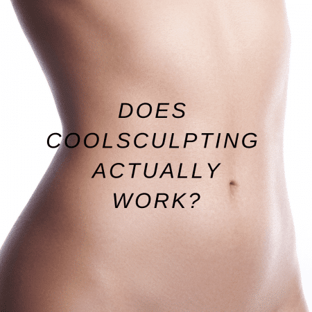 Does CoolSculpting Work?