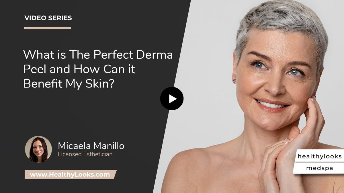 What is The Perfect Derma Peel and How Can it Benefit My Skin?